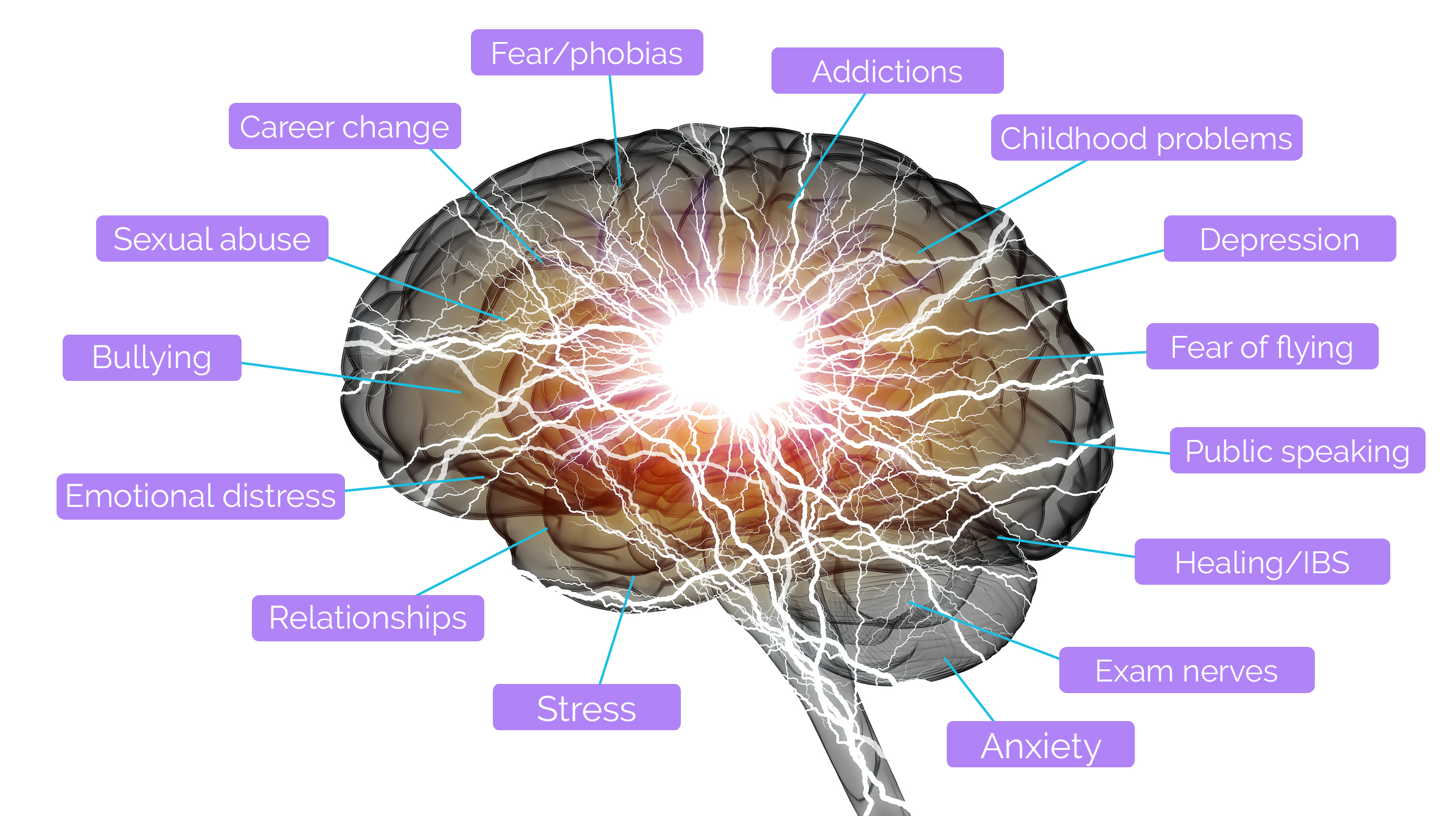 Shiny brain in between thunder lightning on white background